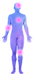 Deposit-throughout-body